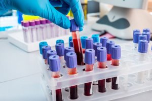 Blood Testing Tips