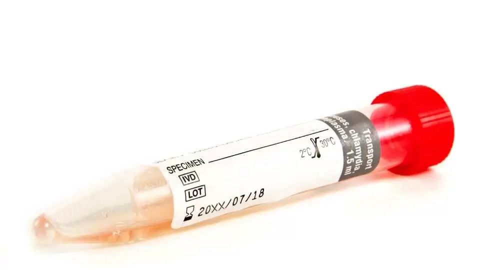 std test specimen