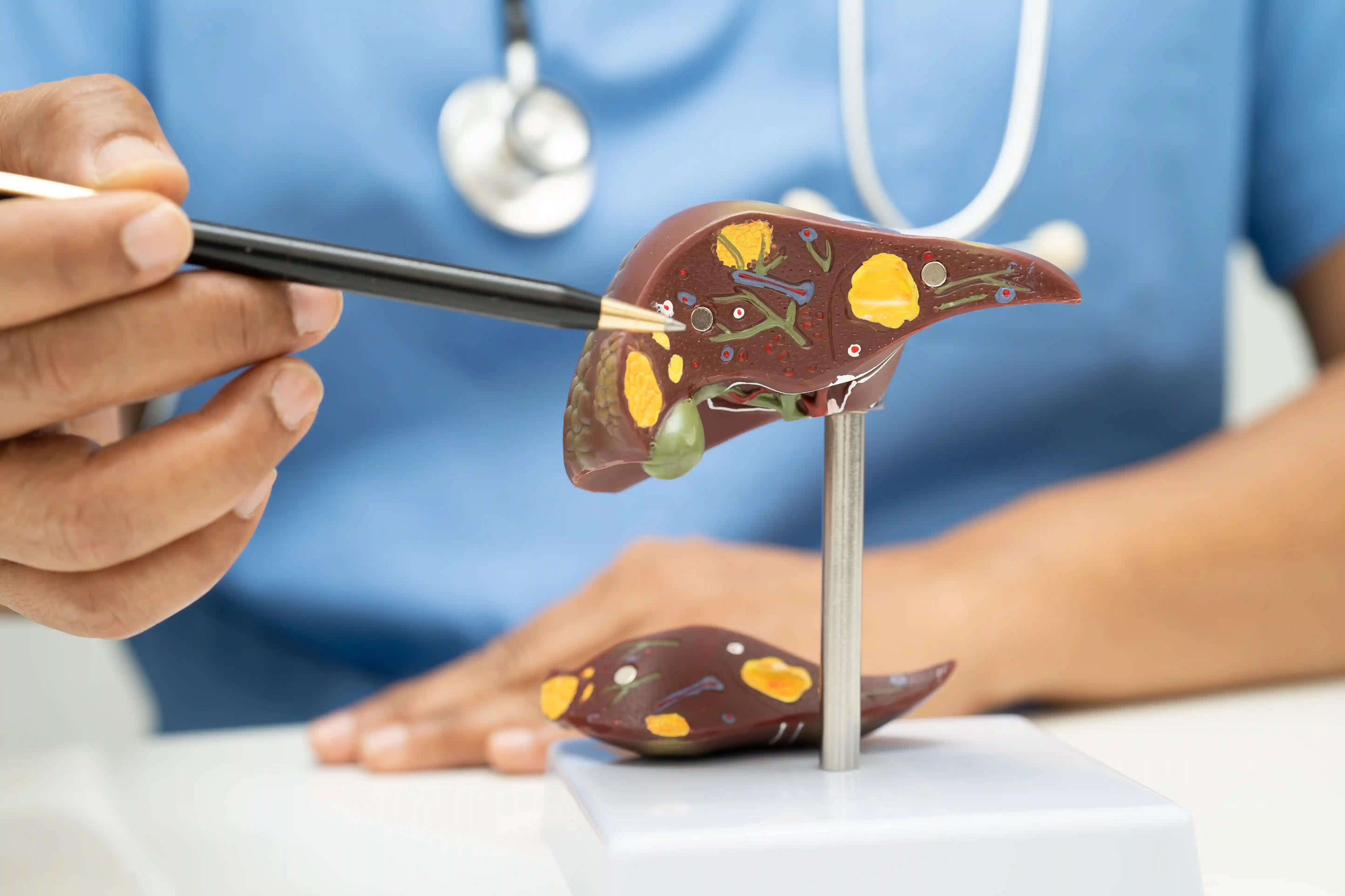 Model of a human liver being examined by a healthcare professional, highlighting liver function and anatomy in a medical context related to liver function tests.